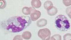 hypogranulatie holtes in het cytoplasma (gefagocyteerd materiaal)