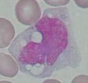 monocytoïde maturatie monocyt grootte: 12-24 mm Ø N/C ratio: 4 2 kern rond,