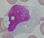 geen (soms kleine nucleool) cytoplasma ruime hoeveelheid grijsblauw vaak fijne