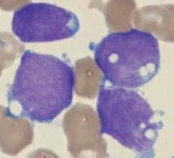 myeloblast) nucleoli: 1-2 (soms onduidelijk) cytoplasma basofiel