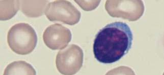 lymfoïde maturatie kleine lymfocyt grootte: