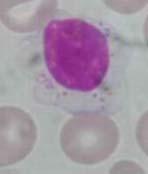 lymfoïde maturatie large granular lymphocyte grootte: >2 RBC kern rond tot ovaal kernchromatine geklumpt nucleoli afwezig/onopvallend cytoplasma