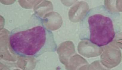 abnormale lymfocyten