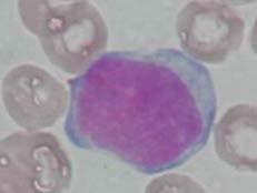 myeloïdematuratie myeloblast grootte: 15-20 µm N/C ratio: