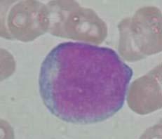 kernchromatine nucleolen cytoplasma basofiel geen/zeldzame
