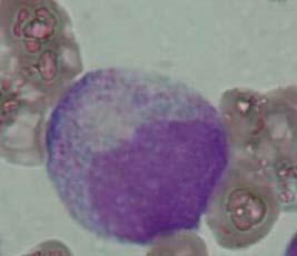 myeloïde maturatie promyelocyt
