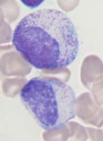 cytoplasma minder basofiel secundaire granules neutrofiel