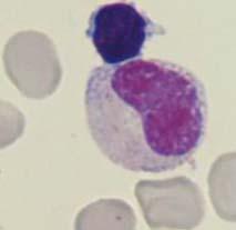 myeloïdematuratie metamyelocyt
