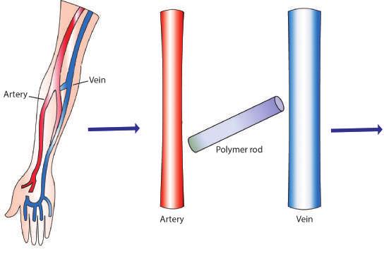 8 Fig. 1. Schematisch overzicht van vascular tissue engineering methode. Een synthetisch staafje wordt onderhuids in de arm geïmplanteerd. Dit staafje wordt omkapseld met weefsel.