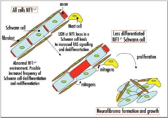 Fig Model voor neurofibroomvorming. uit: Harrisingh, Lloyd, Cell Cycle 2004; 3:e69-72 In NF1 patient zijn alle celltypen NF1+/- tot een supopulatie van Schwann cellen LOH ondergaan en NF1-/- worden.