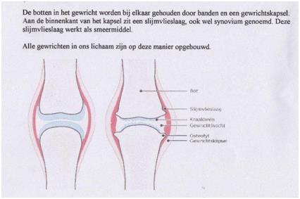 ARTROSE Artrose is het verlies van kraakbeen Heup, knie, vingers, nek en rug Vaker bij