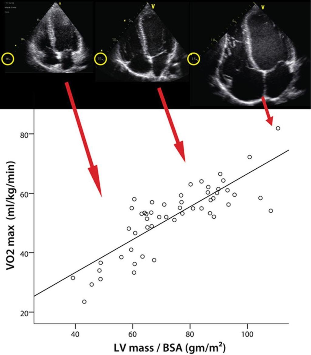 Functionele aanpassing: LV Toename slagvolume, hartminuutvolume