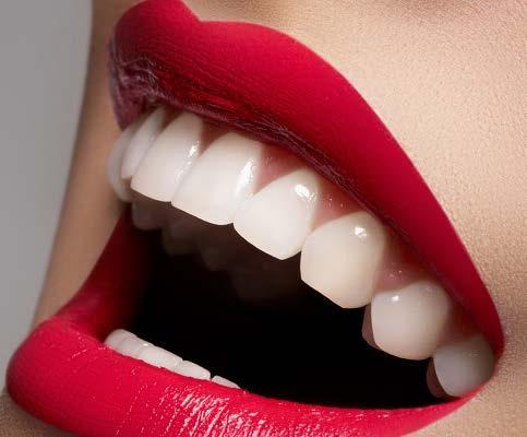 Tandenbleken Tanden bleke is heel populair. Daarom bieden steeds meer salons dit aan in hun praktijk. Echter zonder kennis en ervaring is het moeilijk om de behandeling correct uit te voeren.