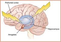 Neurobiologie Hersenstructuren met specifieke functies Amygdala: integreert emotionele, zintuiglijke en hogere cognitieve informatie Centrale speler in perceptie en verwerking