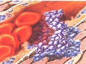 1: Inflammatiefase: (duur 1 tot 4 dagen) Na het stoppen van de bloeding bevinden zich in het wondbed dode cellen en veelal ook microorganismen (debris).