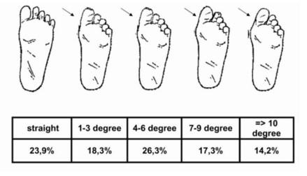 Zijn voeten zijn 43 cm lang; Bij 60 % van de kinderen is de ene voet 2 tot 6 mm langer dan de andere voet; Het zou pas gek zijn als je 2 totaal dezelfde voeten hebt!