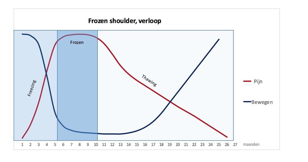 Verloop Frozen Shoulder Klassiek beloop NB: anders bij risicogroepen: - Diabetus