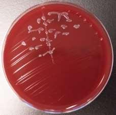 PATIENT 6 Midstream, wbc