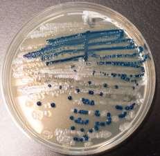 000 cfu/ml E.cloacae >100.