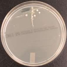 Corynebacteriën spec.10-100.