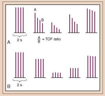 Patronen van stimulatie:train of four(tof) 4 stimuli van 2 Hz, om de 0,5 msec Diepe