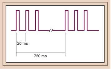 Patronen van stimulatie: Double burst(dbs) 2 keer 3 stimuli van 20msec (om de 750msec) Ratio