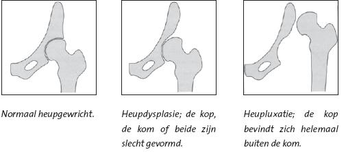 Doordat de heupkom niet diep genoeg is, bedekt deze de heupkop niet goed. De heupkop kan dan uit de ondiepe kom glijden.