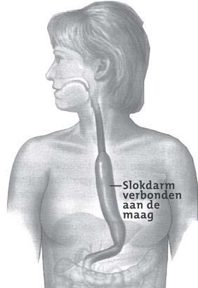 zorg Streef mean arterial pressure (MAP)