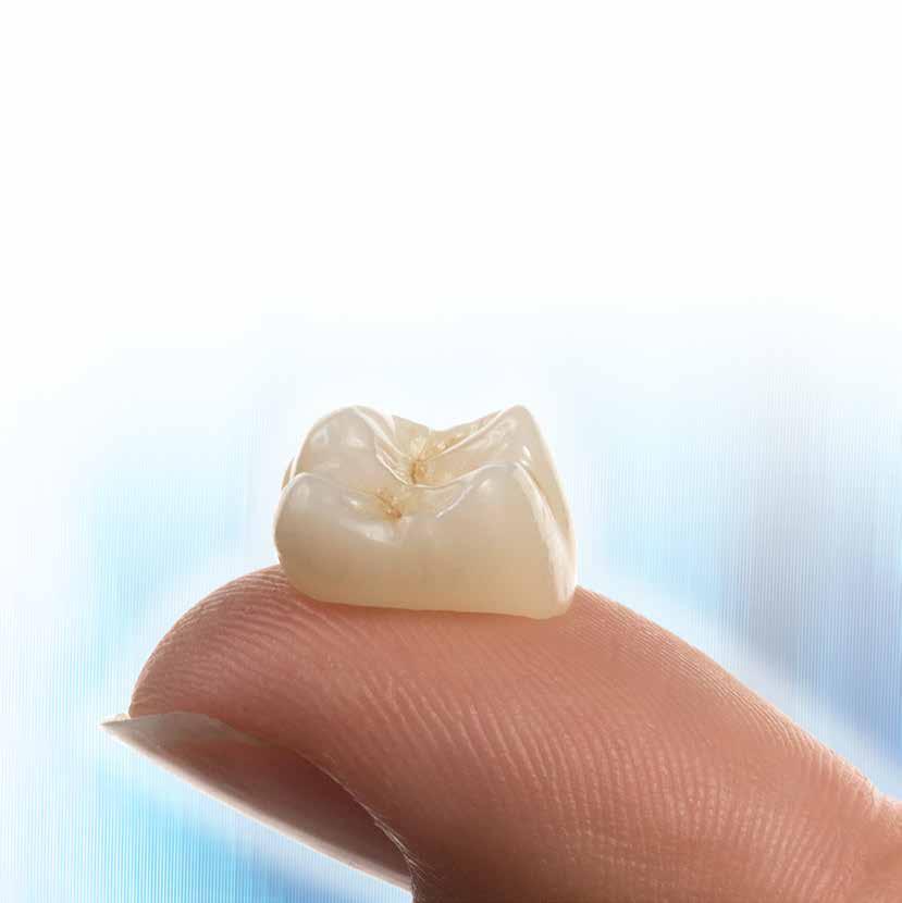 Wat is kroon- & brugwerk? Stel dat een tand of kies zo slecht is, dat vullen niet meer mogelijk is. In zo n geval kan de tandarts een kroon of brug adviseren.