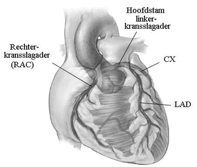 Als een hartklep niet voldoende opengaat of sluit, kan de bloedtoevoer van of naar het hart gestoord worden. 1.4.