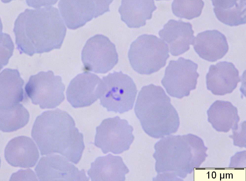 trofozoïet van Plasmodium ovale in P/ 568.