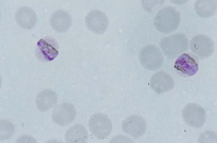 Figuur 5.: Twee bandvormige trofozoïeten met veel donker pigment van Plasmodium malariae.