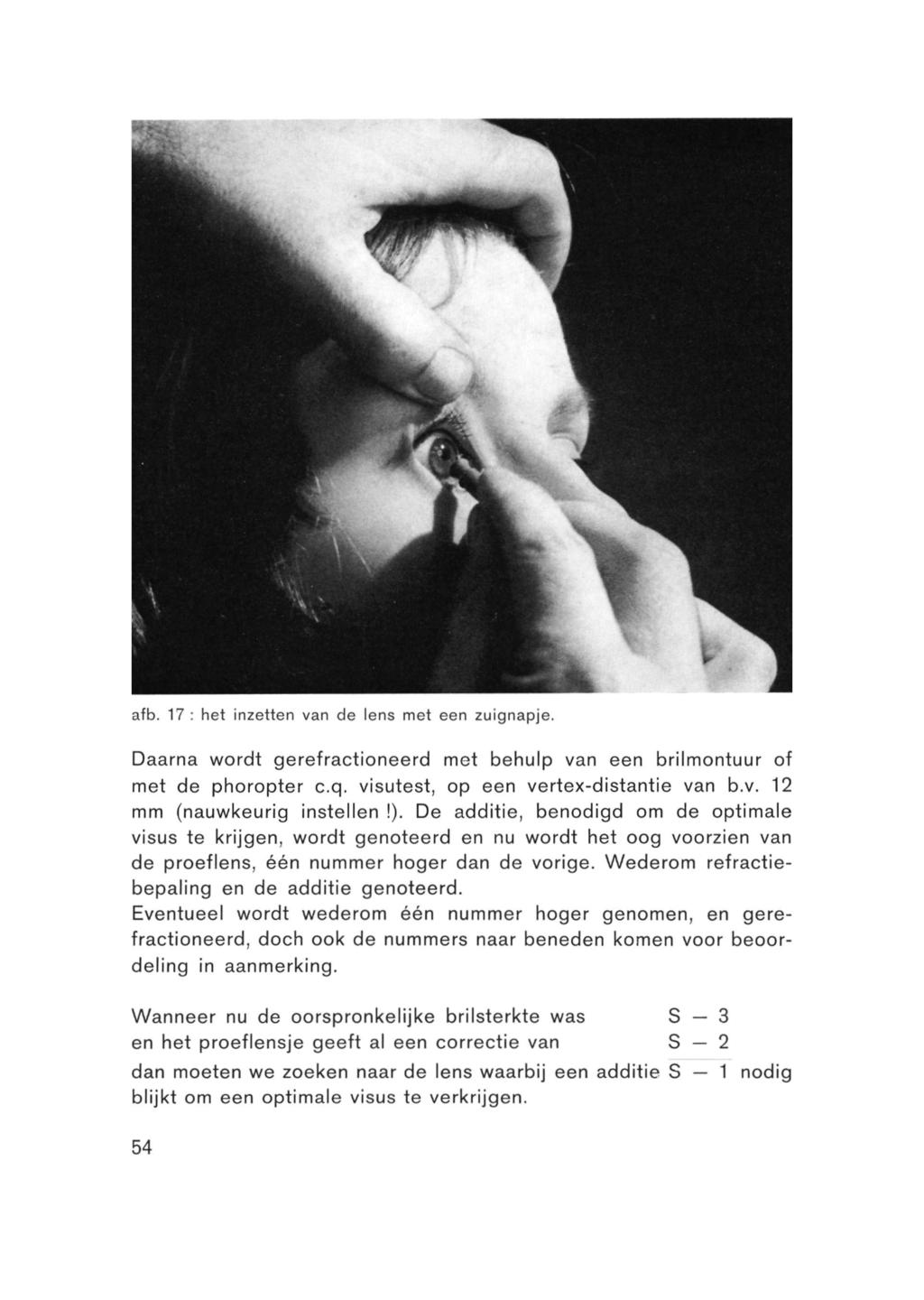 afb. 17 het inzetten van do lens met een zuignapjo. Daarna wordt gerefractioneerd met behulp van een brilmontuur of met de phoropter c.q. visutest, op een vertex-distantie van b.v. 12 mm (nauwkeurig instellen!