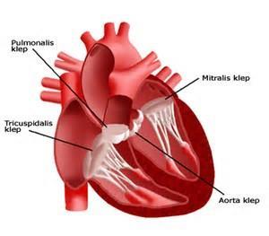 kleplijden Linkszijdige kleppen: aortaklep en mitralisklep Rechtszijdige kleppen: pulmonalisklep en