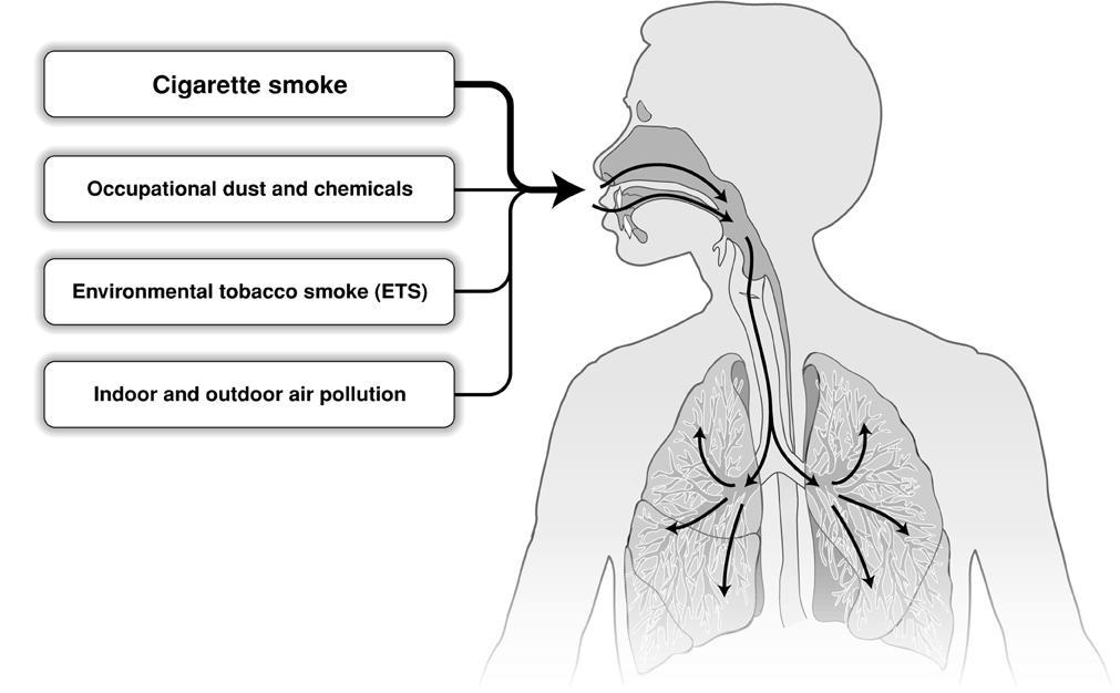 COPD: roken is de belangrijkste risicofactor!