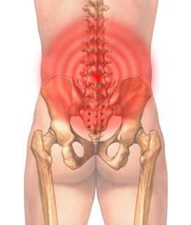 STAP 1: Weet wat uw lage rugpijn inhoud en betekent! 1.1 Spit, lumbago of lage rugpijn? Lage rugpijn wordt in de volksmond ook wel Spit genoemd.