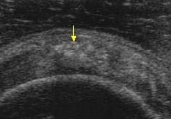 echografie