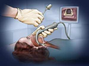 fiberoptic intubation videolaryngoscoop fiberoptic