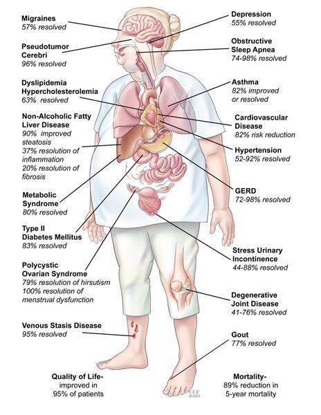 Cleveland Clinic Foundation (CCF) The