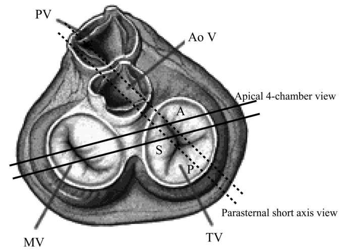 Anatomische positie TV