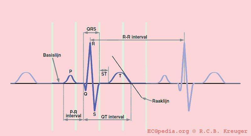 Verworven QT verlenging. Er zijn drie grote factoren die van invloed kunnen zijn op de repolarisatie-/ en depolarisatie (QT) van het hart.