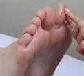 schoenen van onze voetpatiënten hebben gehaald. In andere gevallen verbrandt de patiënt zijn voet door contact met een warmtebron.