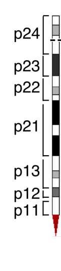 Mechanismen van PD-1 Ligand Expressie in chl 1. Genetics 2. STAT Signaling 3.