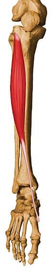 BESCHRIJVING MIDDENVOET MUSCULI Aandoening van de aanhechting van de spier musculus tibialis anterior (insertietendopathie musculus tibialis anterior) Aandoening van de insertie van de m.