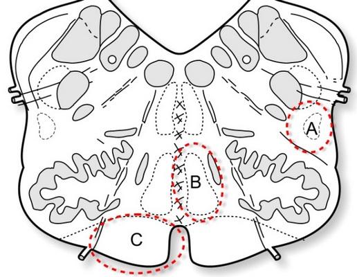 pagina 10 van 27 Originele bron: Anatomie en Neurowetenschappen Bovenstaande afbeelding toont een schematische weergave van een doorsnede door het myelencephalon.