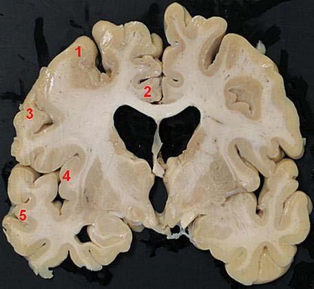 pagina 13 van 27 De afbeelding laat een detail zien van een doorsnede door de cerebrale cortex. In de primaire visuele schors is laag IV veel dikker dan in de primaire motor cortex.