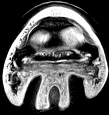 Figuur 20: MRI beeld van de linker voet, transversale snede, T2.