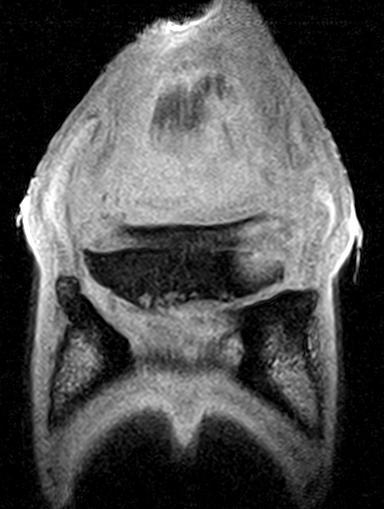 Figuur 37: MRI beeld van de rechter voet,