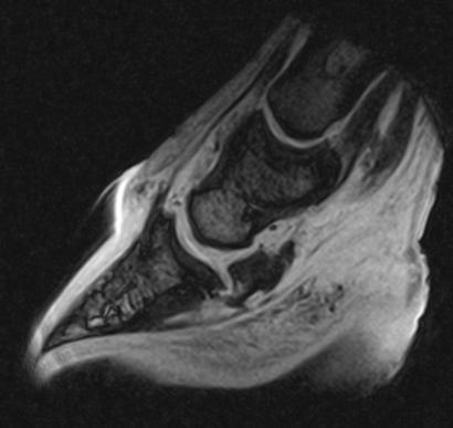 Figuur 26: MRI beeld van de rechter voet,