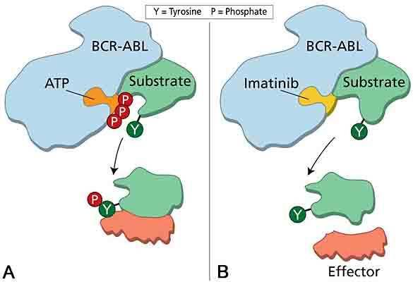 Tyrosine kinase inhibitoren (TKI):